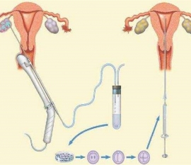 35岁女性备孕请做好以下检查，“健康长沙代生宝宝”跑不远